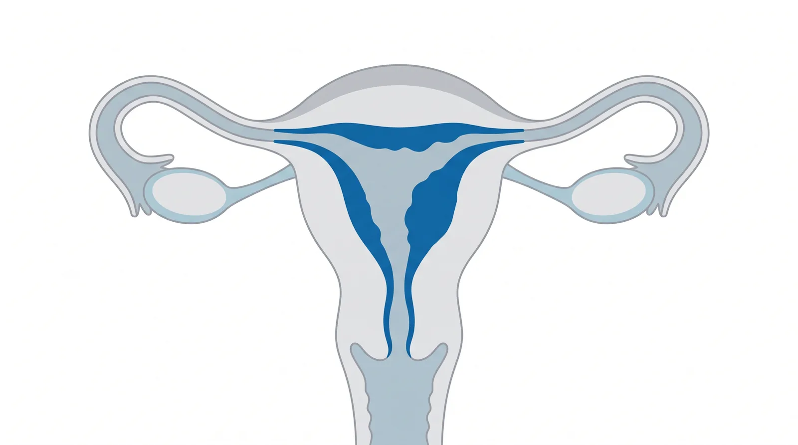 Dibujo del útero con la capa interna (endometrio) engrosada